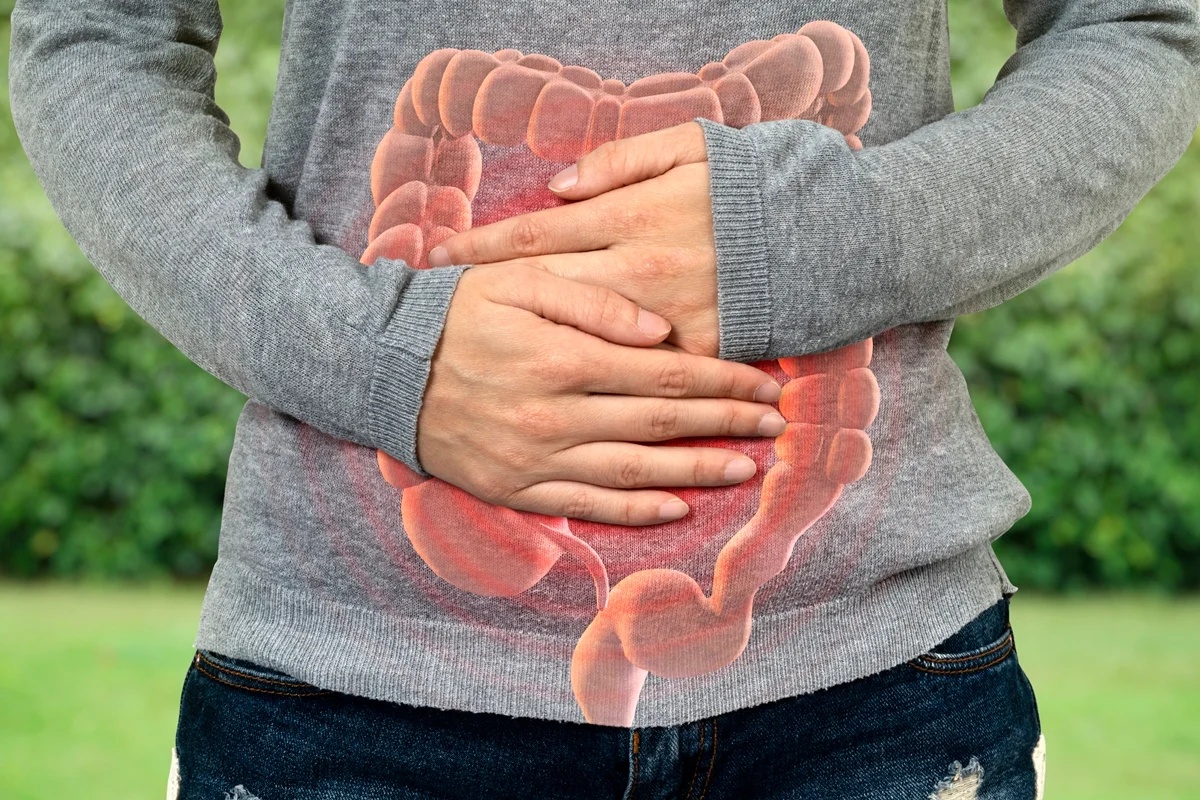 Diagnóstico precoce de câncer de intestino revela diferenças biológicas e maior sobrevida em pacientes jovens