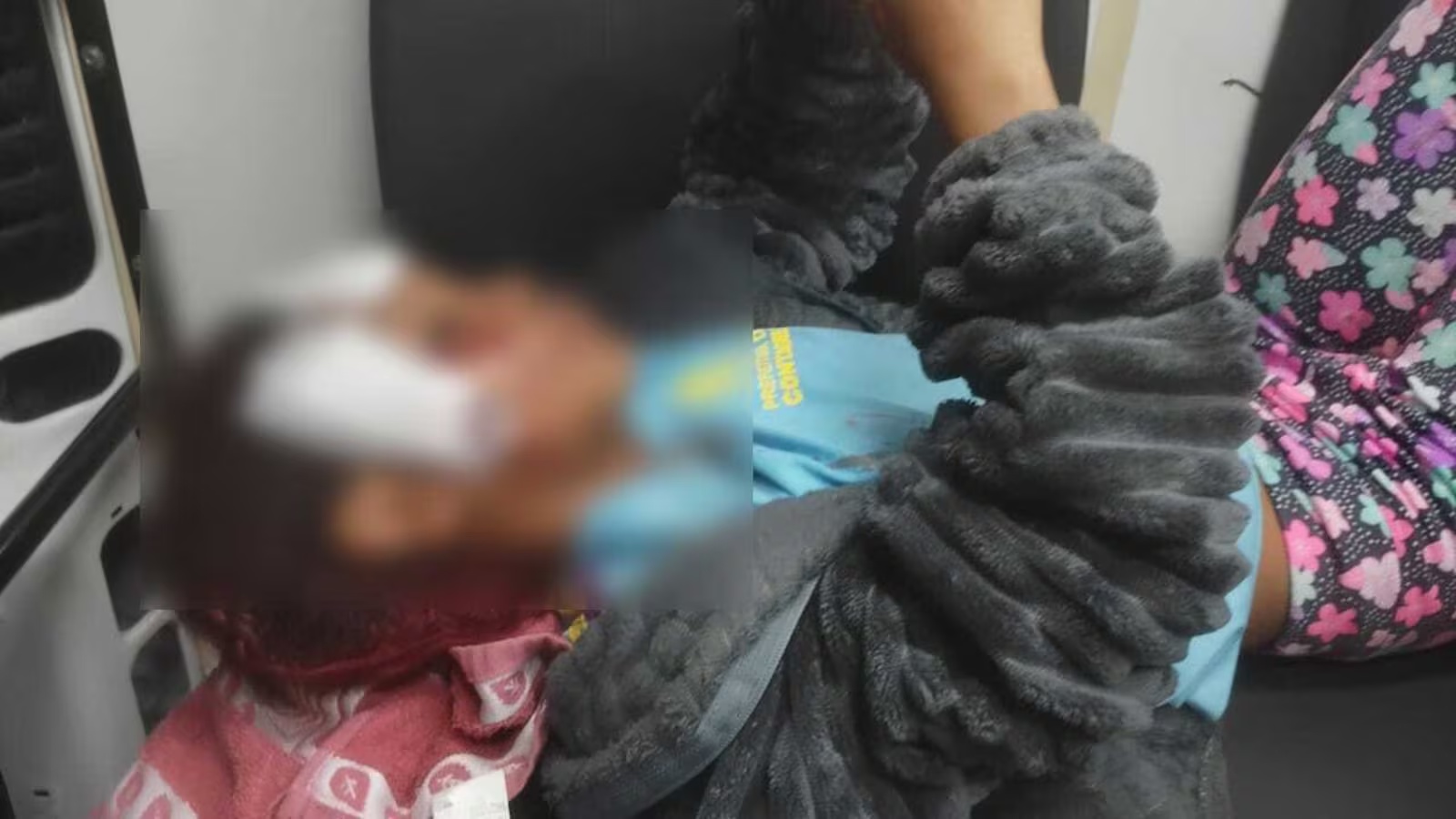 Menina de 7 anos sofre ferimentos no rosto após queda de patinete ao fugir de cachorro em Contagem