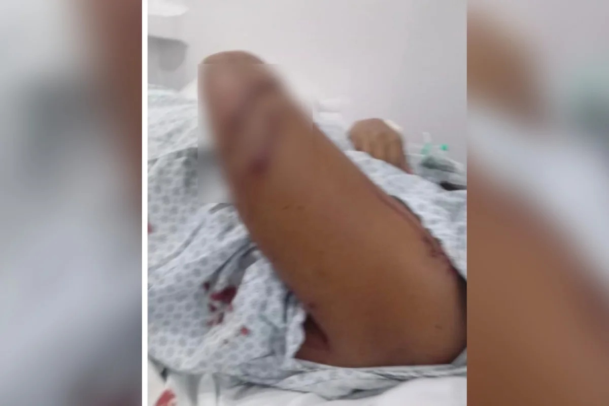 Mulher grávida é atacada com cacos de vidro por companheira do ex-namorado em Rio Verde, Goiás