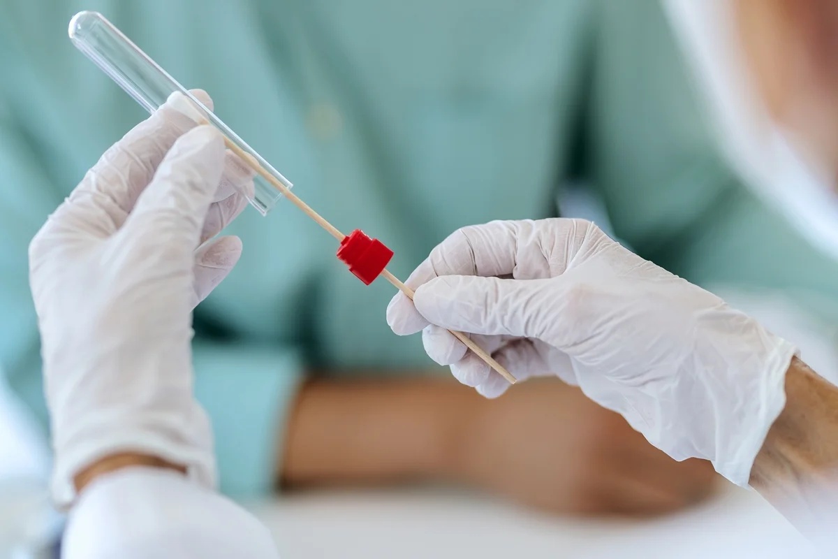 Teste com cotonete vaginal é estudado para reduzir biópsias em casos suspeitos de câncer de endométrio