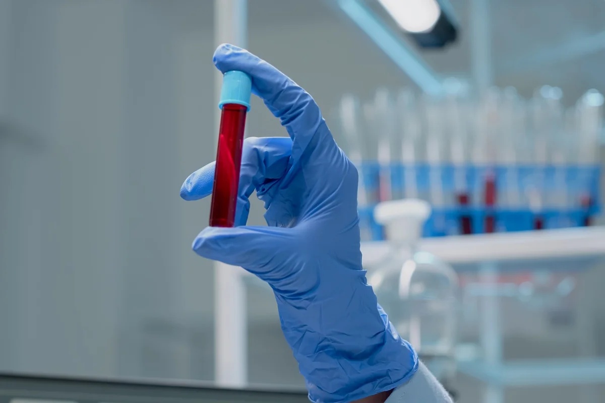 Exame de sangue capaz de detectar mais de 50 tipos de câncer chega ao Brasil