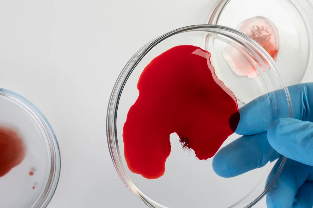 Estudo revela que jejum prévio ao exame de sangue pode não ser necessário na maioria dos casos