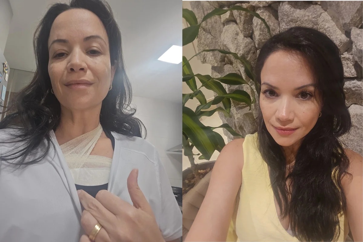 Médica psiquiatra de Brasília enfrenta câncer de mama após diagnóstico em 15 dias