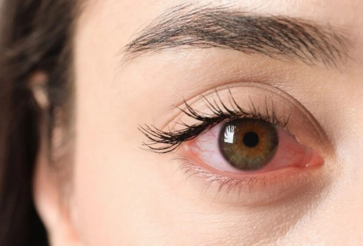 Produtos de beleza e higiene pessoal causaram mais de 42 mil lesões oculares nos EUA em 20 anos