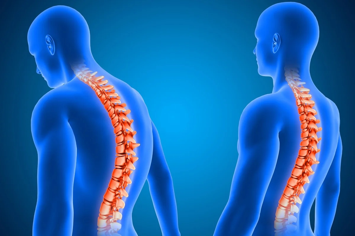Equipe médica na Rússia realiza primeiro transplante de medula espinhal em humano, sem confirmação de recuperação funcional